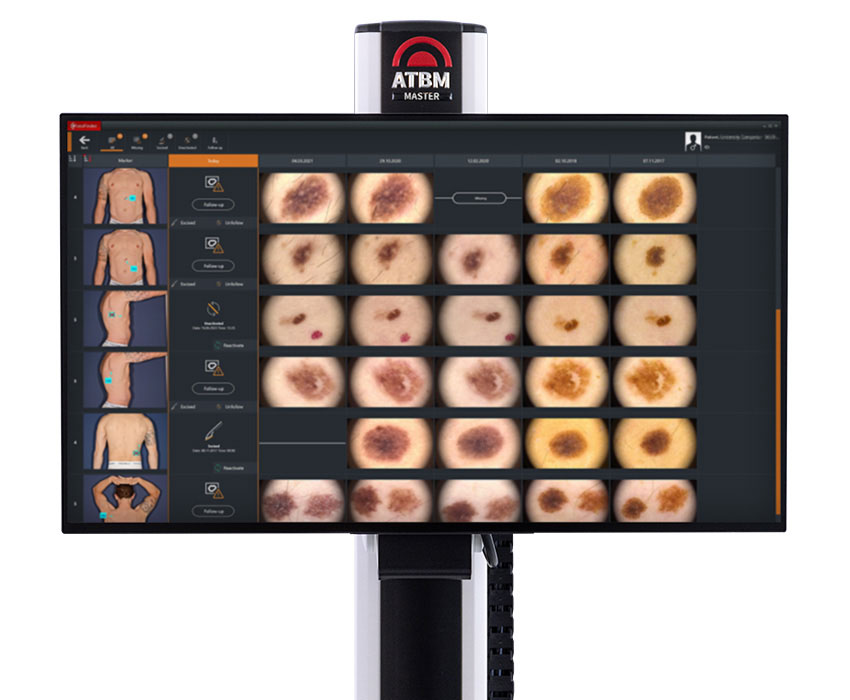 Total Body Mapping